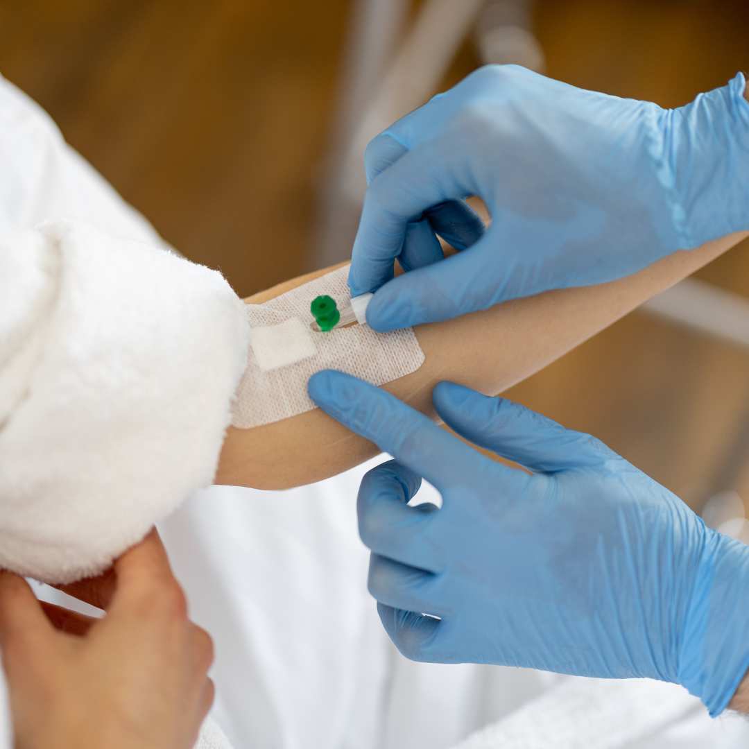 Катетеризация вен