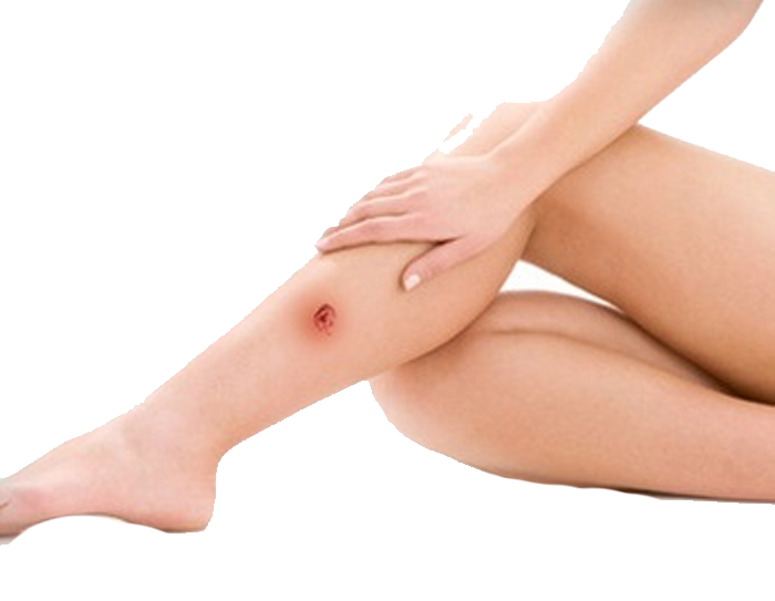 Як поставити крапельницю?