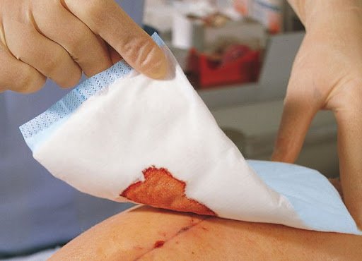 Перев’язки на дому