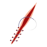 Зняття хірургічних швів