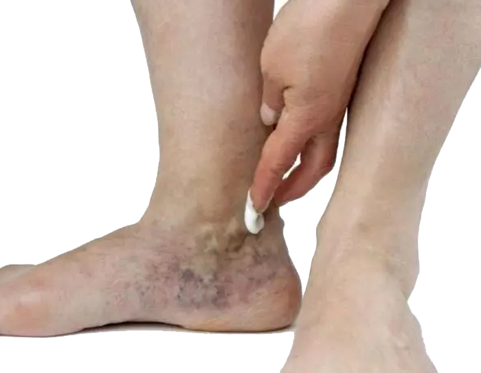 Куди можна зробити укол самому собі?